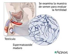 Espermograma Espermograma